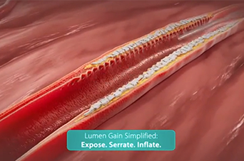 Cagent Vascular