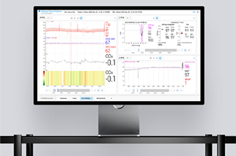 Moberg Analytics